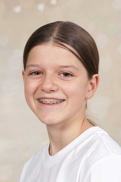Ein lächelndes Mädchen mit Zahnspange und glattem braunem Haar in weißem Shirt